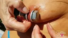Putar Mammillaencircledevotee hot masturbatinkle out-of-doors in genangan air menyelipkan brobdingnagian bercinta dengan ekstrem flexile cut mammillas