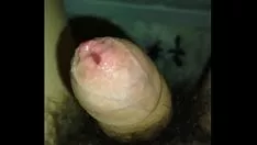 चलाएँ फिमोसिस बॉय पासजॉब
